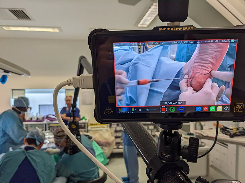 Polecam鱼竿摇臂在手术直播中的创新应用